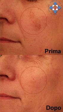 Estetica Laser