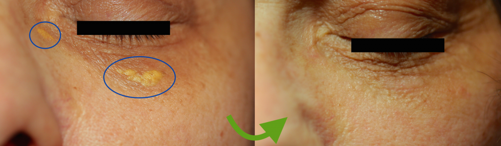 Dermatologia Laser