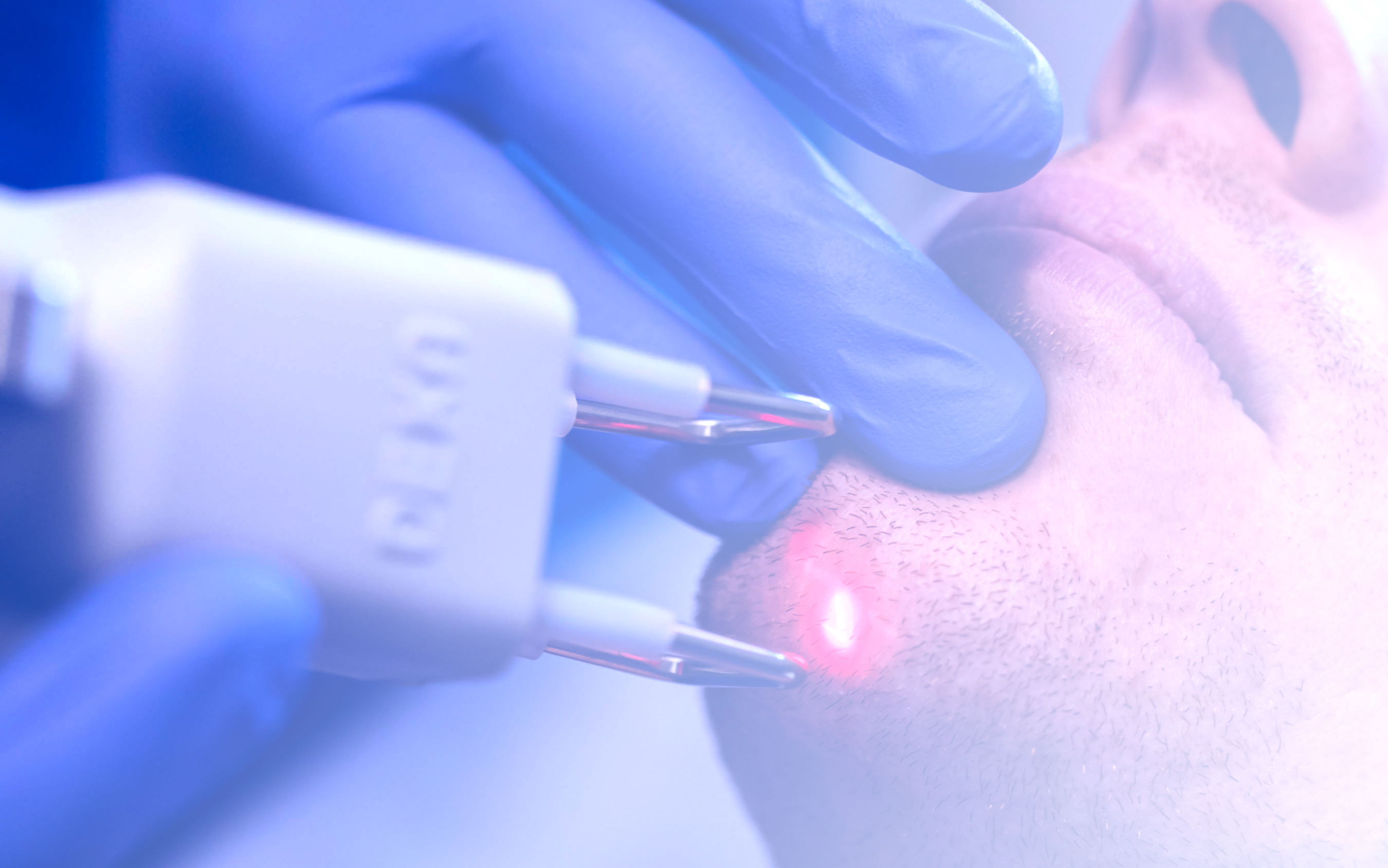 Laser Milano Centro Clinico Via Milano