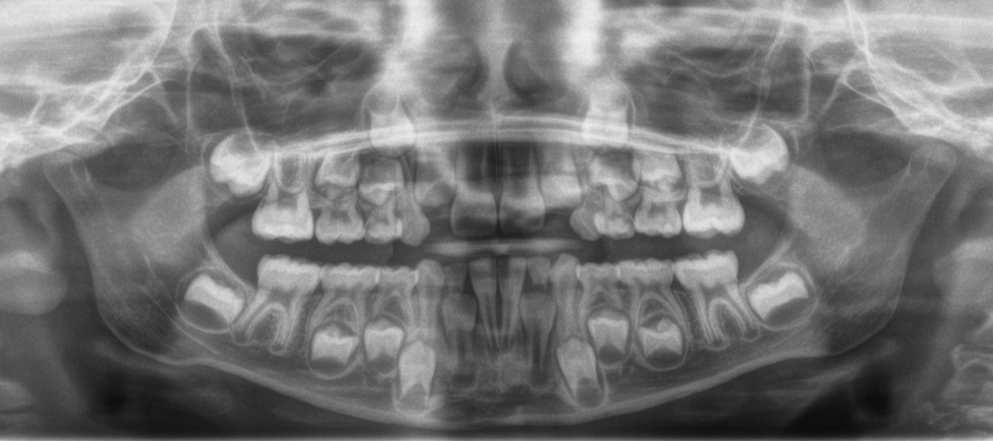 Radiologia
